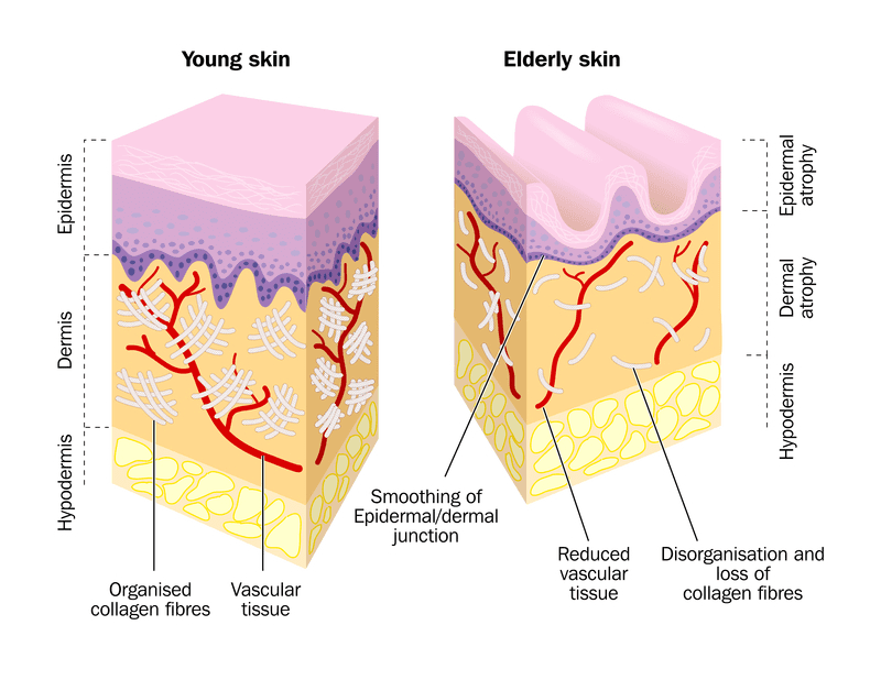 comparison-young-old-skin